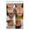 Buy cheap 2023 Hot selling 7D Facial Lifting Anti-Wrinkle Beauty Salon Equipment from wholesalers
