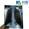 Buy cheap Free Sample Inkjet X Ray Paper Film Imaging Printed By Printer For Radiology Medical Diagnosis 8*10 Printer from wholesalers