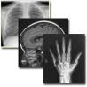 Buy cheap Scratch-resistant 25cm * 30cm Medical Film Xray Paper For Konida Laser Printer from wholesalers