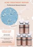 Private Label Stalidearm Meso Acne Removal Serum Vials Acne Treatment No Needle