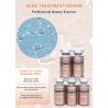 Buy cheap OEM ODM Stalidearm Anti Acne Serum Herbal Treatment Skin Repair Care Solution Anti Acne Pimple Scar Remover Face Serum from wholesalers