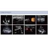 Buy cheap Cardiovascular Cardiology Portable Full Figital Color Doppler Ultrasound Scanner Machine from wholesalers