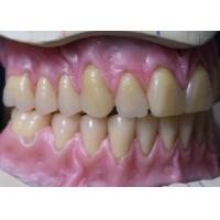 Buy cheap Hot Cured Full Arch Removable Acrylic Full Denture product