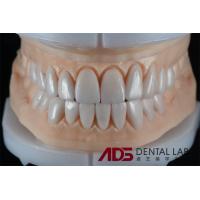 Buy cheap China Dental Lab Laminate Dental E-Max Veneer Self Adhesive product