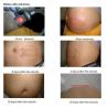 Buy cheap 2014 Newest cryolipolysis body slimming beauty machines, ultrasonic rf vacuum from wholesalers