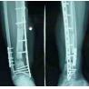 Buy cheap Medical Paper Laser Printer X Ray Diagnostic Imaging For Hospital from wholesalers