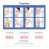 Buy cheap 3500W 808 Nm Diode Laser Hair Removal Machine Hair Loss Treatment Machine from wholesalers