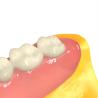 Buy cheap Dental 3D Printing Invisible Denture Base Resin from wholesalers