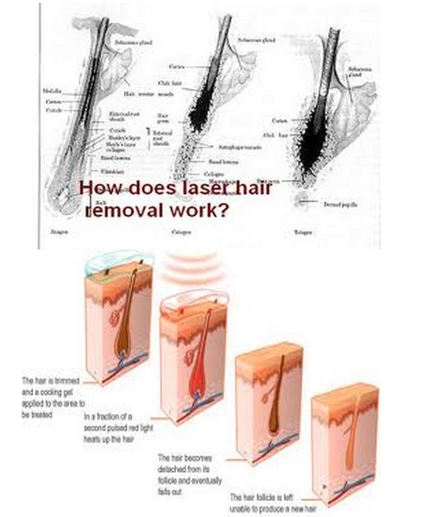 hot sale high quality Laser sapphire permanent 808nm diode laser hair removal machine price for sale