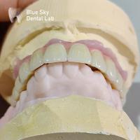 Buy cheap Implant Operation Cases / Implant Procedure Cases for Diverse Implant Choices product