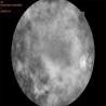 Buy cheap 2.8mm Wide Field Fundus Camera Retinal Imaging Equipment from wholesalers