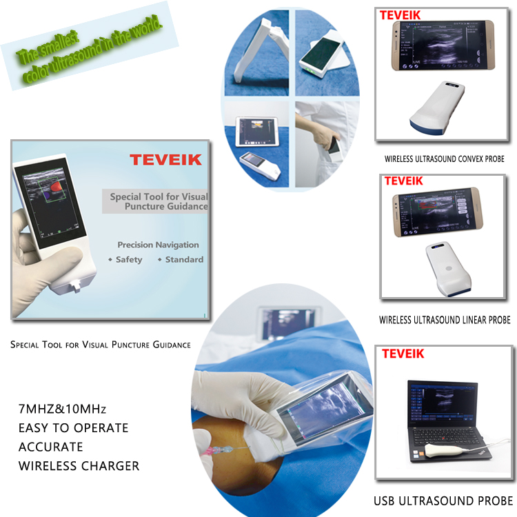 3.5W 7MHz Ultrasound Scanner Doppler Probe Lithium Battery