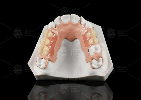 Buy cheap White And Pink Peek Flexible Acrylic Partial Denture With Excellent Resistance from wholesalers