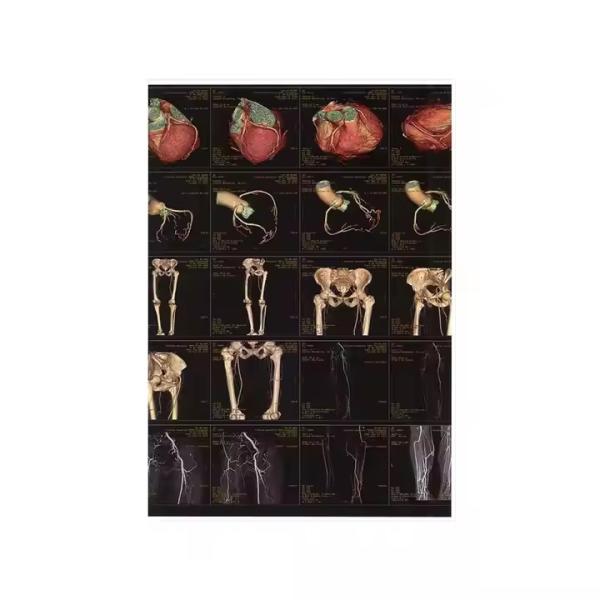 Buy cheap Medical X Ray Film Dry Thermal For Printer from wholesalers