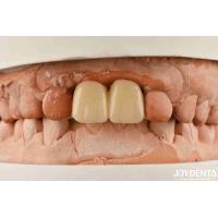 Buy cheap Multilayer PMMA Polymethyl Methacrylate For Dental Restorations product