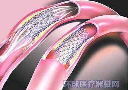 Buy cheap NiTi Parts Medical Wire Forming , OEM Manufacturing Custom Metal Forming from wholesalers