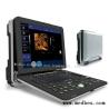 Buy cheap Medical Diagnostic Ultrasounic Machine Hospital Fetal doppler Ultrasound Scanner from wholesalers