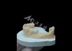 Highly-rated Solid Zirconia Crown For Satisfying Dental Restorations