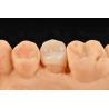 Buy cheap Customizable White Composite Inlay Onlay Natural Looking Minimally Invasive Tooth Restoration from wholesalers