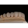Buy cheap Smooth And Lightweight Dental Veneers Biocompatible And Comfortable For Oral Health from wholesalers
