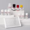 Buy cheap Carcinoembryonic Antigen CEA ELISA Cancer Marker Test KIT Laboratory Or Hospital High Precision from wholesalers