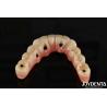 Buy cheap Dental Titanium Malo Implant Bridge Combining Traditional And Modern Techniques from wholesalers