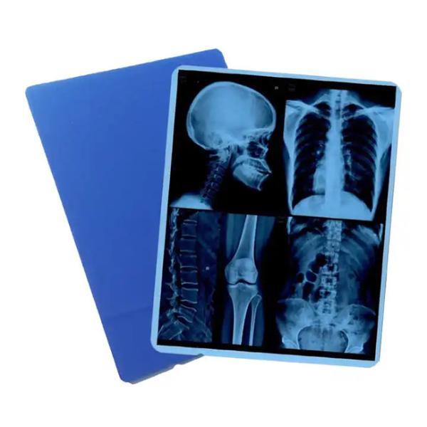 Buy cheap Industry Leading Production Our Professionally Produced Medical Blue X - Ray Film For Laser Printing Is The Go - To Choice. from wholesalers