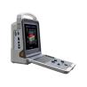Buy cheap 12 Inch LED Portable Ultrasound Scanner Color Doppler 4D Ultrasound Machine from wholesalers