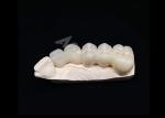 Translucency Natural Esthetics Solid Zirconia Crown For Teeth Chipping Resistant