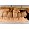 Buy cheap Restoration Of Missing Teeth Implant Crown and Bridge Safe For Oral with Accurate Fit from wholesalers