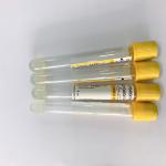 Non Vacuum Gel And Clot Activator Tube Good Compatibility Easy To Use