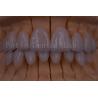 Buy cheap FDA/ISO/CE Certified Digital Crown Teeth Artificial Crown Any Size from wholesalers