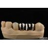 Buy cheap Abrasion Resistant Metal Alloy Crown For Customized Dental Restorations from wholesalers