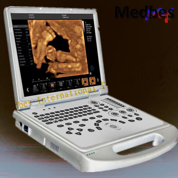 Buy cheap Ce Approved Medical Portable 4D Color Doppler Ultrasound Scanner from wholesalers