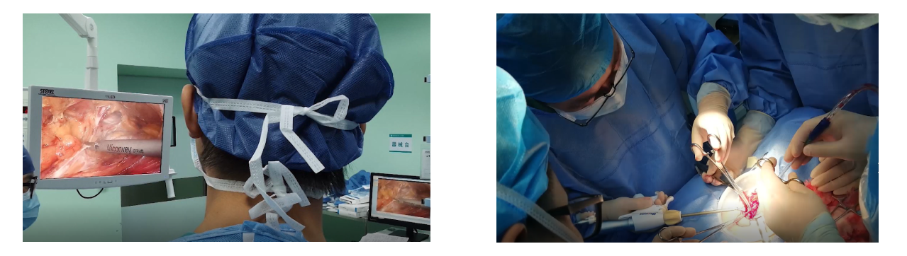 Ultrasonic Harmonic Scalpel applications