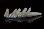 Dental Porcelain Feldspathic Veneers For Teeth Custom Shaped