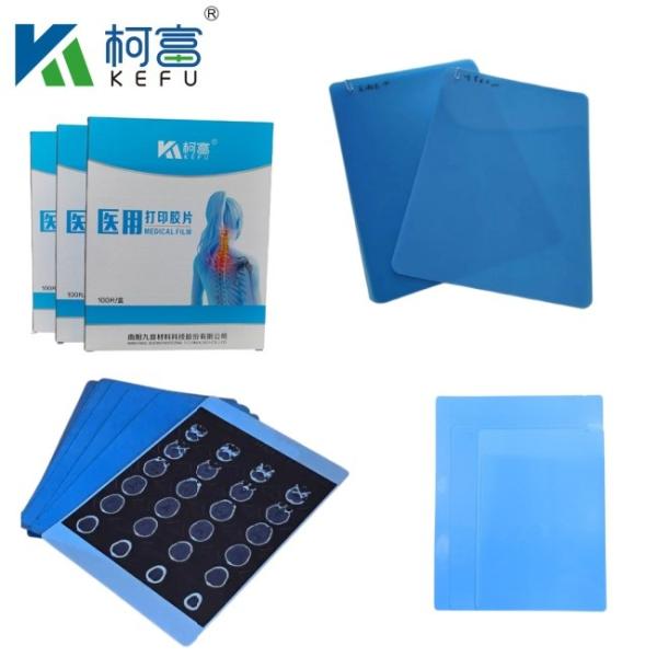 Buy cheap Wholesale International Medical Inkjet Film Blue X-ray Film Thermal Films For Clinics And Hospitals from wholesalers