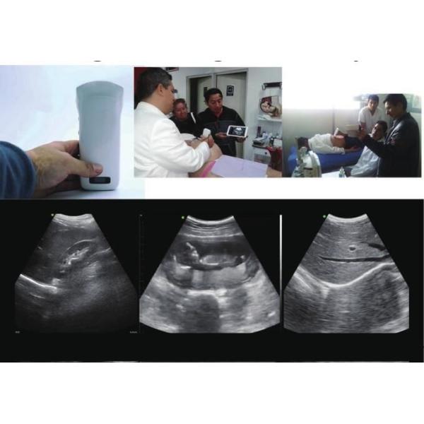 Handheld Black And White Ultrasound Machine Portable Wireless Ultrasound Machine With Convex And Linear 128 Elements 2