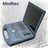 Buy cheap New 4D Color Doppler Ultrasound System from wholesalers