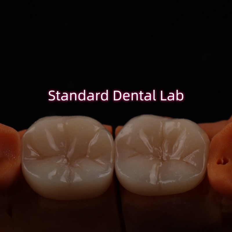 Full Contour Bruxier Monolithic Zirconia Crown Bridge Dental Lab