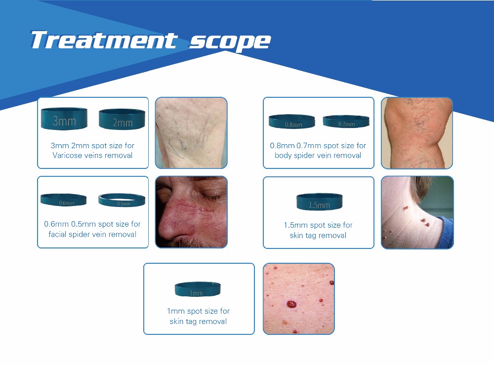 Latest technology no down time CE FDA approved blood vessel removal diode vascular laser 980 nm beauty machine