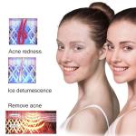 Electric Depilador Home Beauty Machine Laser Epilator Hair Removal Permanent