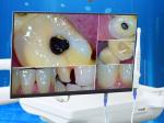 Wall Mount Dental Desktop Computer Monitor 21.5 Inch White LCD LED Screen