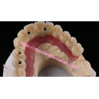 Buy cheap Multi Layer Zirconia Screw Retained Implant Bridge Biocompatible On Metal product