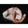 Buy cheap Hybrid Pink Porcelain Implant Crown Malong Full Arch Implant Bridge Immediate Loading from wholesalers