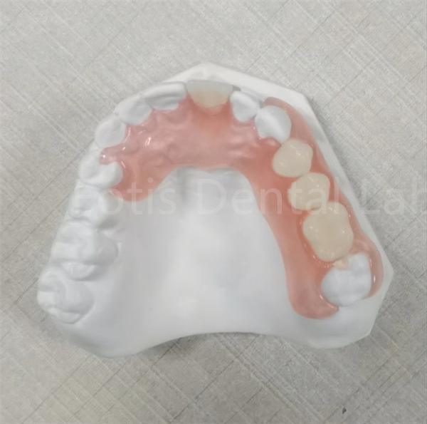 Buy cheap Pink / Transparent TCS Valplast Odor Resistant Flexible Dental Prosthesis from wholesalers