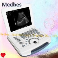 Buy cheap Hospital 15 TFT Color Medical Portable Ultrasound Machine product