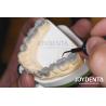 Buy cheap Highly Accurate Temporary Dental Diagnostic Wax Up Customized 1-2mm Thickness from wholesalers