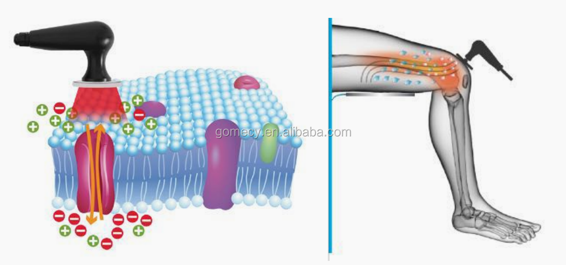 Tecar (10).png