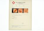 Scratch-resistant X-ray Paper Medical Film For KND-DRYTEC-3000, KND-DRYTEC-4000
